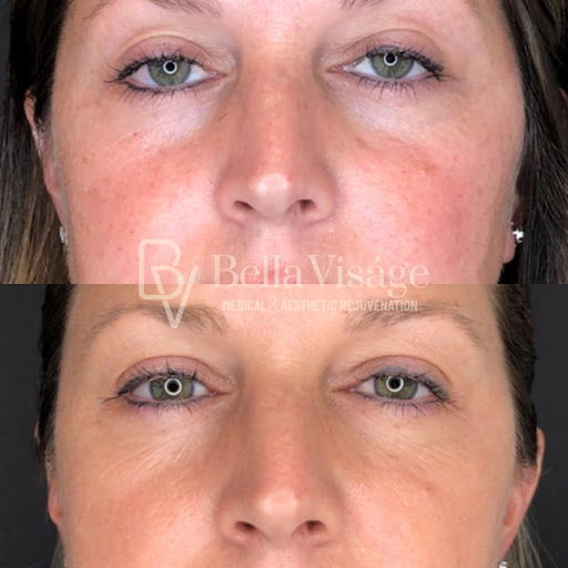 Explore minnesota tattoos ideas, creative tattoo ideas in Lakeland, available at Bella Visge Medical & Aesthetic Rejuvenation