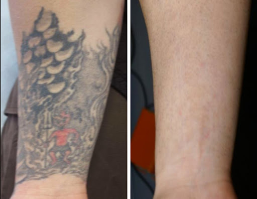 Explore small grandparents tattoo ideas, creative tattoo ideas in Lexington, available at Inkund Laser Tattoo Removal Lexington