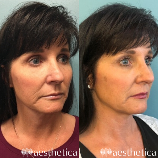 Explore fist tattoo ideas, creative tattoo ideas in Pleasant Grove, available at Aesthetica