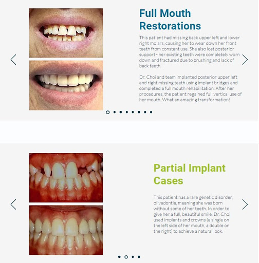 Advanced Implant Dental