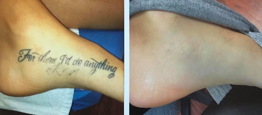 Explore adventurer tattoo ideas, creative tattoo ideas in Houston, available at Houston Tattoo Removal Clinic