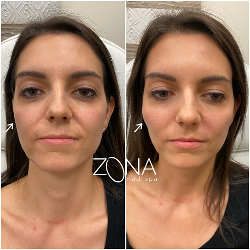 Skin Care Clinic «ZONA MED SPA», reviews and photos, 9767 N 91st St #102, Scottsdale, AZ 85258, USA