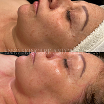 Ensō Skincare & Wellness - Photo 7 - Car repair in Chandler, AZ, Chandler