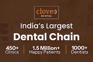 Clove Dental Clinic - Best Dentist in Kilpauk Garden, Chennai: Painless Treatment, Orthodontist, RCT, Implants & More image