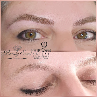 Birmingham Beauty Clinic - Cheltenham - Birmingham Beauty Clinic - Cheltenham