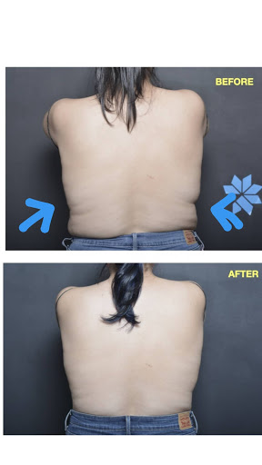 Explore charlie brown tattoo ideas, creative tattoo ideas in Chino, available at SoCal Body Institute