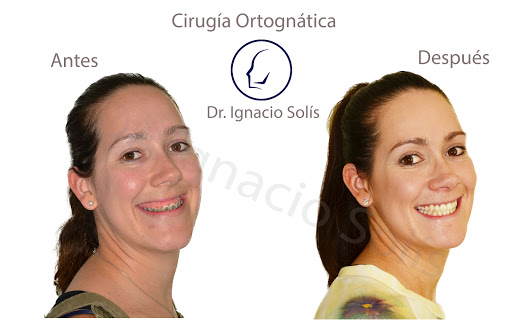 Dr. Solís, Cirugía Ortognática, Cirugía Maxilofacial