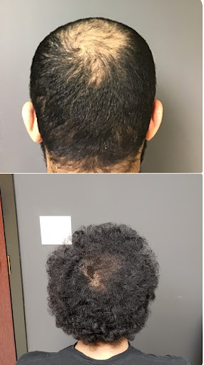 Dallas Hair MD