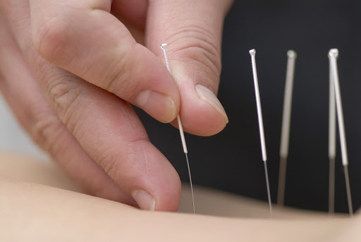 Mike Worley, L.Ac. Acupuncture