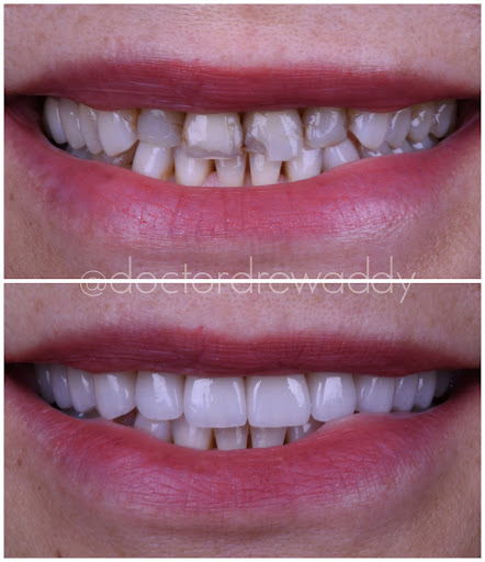 Carlsbad Beach Dental - Drew Addy, DDS image