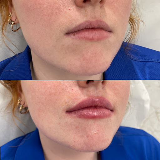 Explore superhero tattoo ideas, creative tattoo ideas in Owensboro, available at The Skin Lab