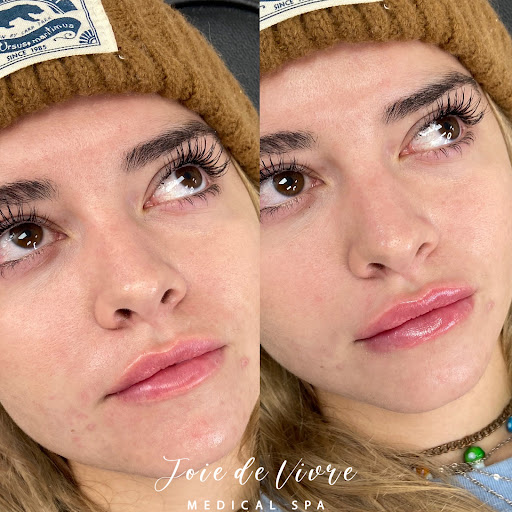 Explore tattoos of basketballs for ideas, creative tattoo ideas in Canton, available at JDV Med Spa