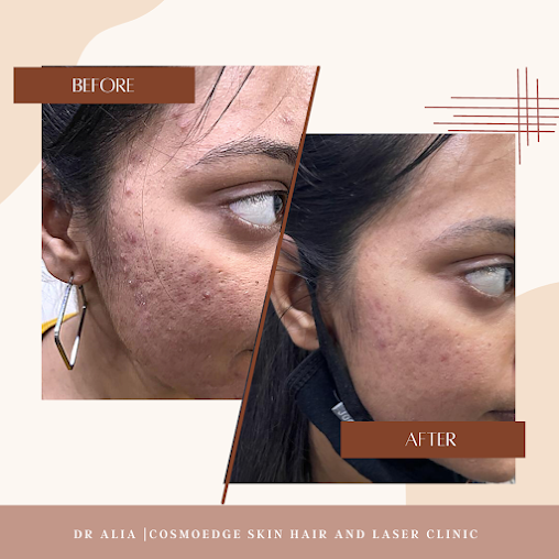 Cosmoedge - Skin & Laser Clinic - Cosmoedge - Skin & Laser Clinic