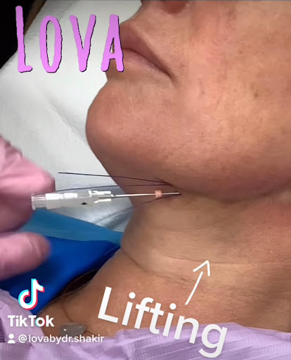 Explore lfc tattoo ideas, creative tattoo ideas in Lake Oswego, available at Lake Oswego Vein and Aesthetic LOVA