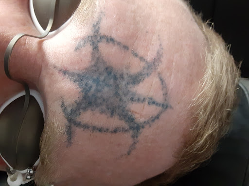 Explore bum tattoo ideas, creative tattoo ideas in Saint Paul, available at Fearless Tattoo Removal