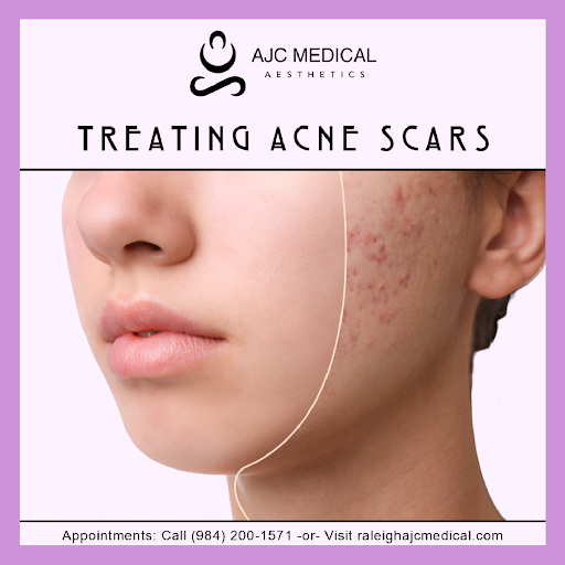 Explore firefighter sleeve tattoo ideas, creative tattoo ideas in Raleigh, available at AJC Medical Aesthetics