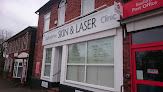 Best Laser Scar Removal Clinics Stoke-on-Trent Near You
