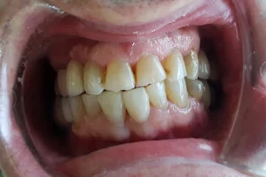 Clínica Dental Álvarez - De Frutos image