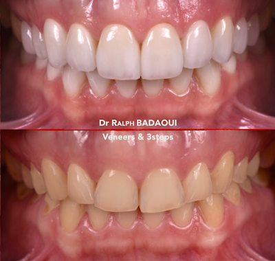 Dr. Ralph BADAOUI ✾ Dentiste Esthétique Paris à Paris