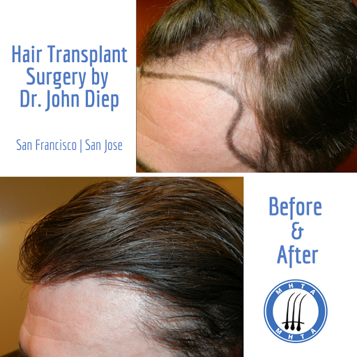 Hair Replacement Service «Medical Hair Transplants & Aesthetics», reviews and photos, 15055 Los Gatos Blvd Suite #110, Los Gatos, CA 95032, USA