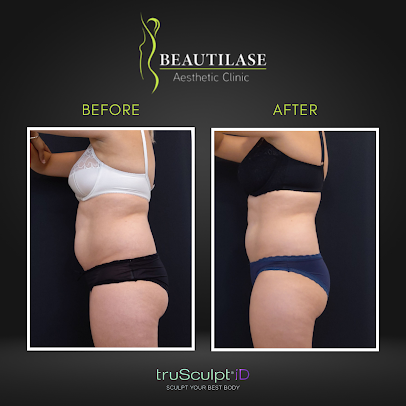 Beautilase - Beautilase