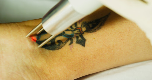 Explore kiss tattoo ideas, creative tattoo ideas in Verona, available at Madison Laser Tattoo Removal