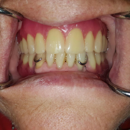 Choice Dentures - Dentist