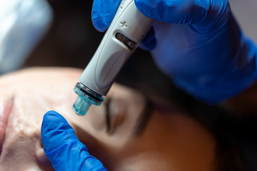 Explore boba fett tattoo ideas, creative tattoo ideas in Commack, available at Evolution MedSpa