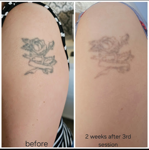 Explore first responder tattoo ideas, creative tattoo ideas in Farmington, available at Zia Tattoo Removal LLC