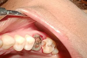 Manohar Dental clinic Dr. A. K.Pandey(K.G.M.U) image