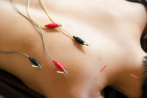 CC Body Mechanics - Acupuncture, Chinese Herbs & Massage image