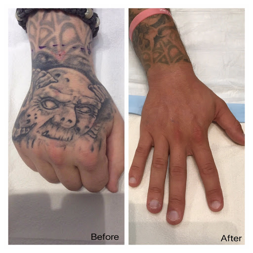 Explore tattoo ideas for women on forearm, creative tattoo ideas in Beachwood, available at Ink On Ink Off IOIO Studio