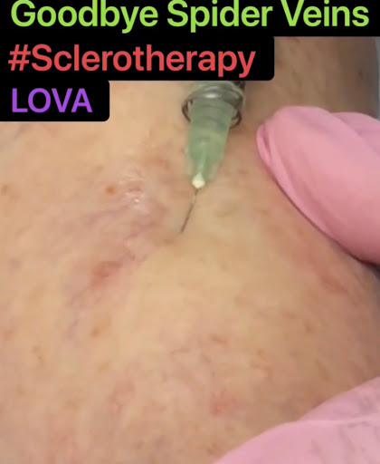 Explore 911 tattoo ideas, creative tattoo ideas in Lake Oswego, available at Lake Oswego Vein and Aesthetic LOVA