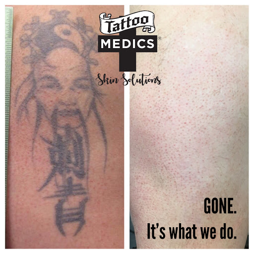 Explore sailor jerry tattoo ideas, creative tattoo ideas in Providence, available at TattooMedics Laser Tattoo Removal
