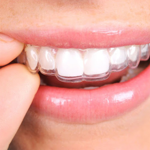 Opiniones de Clinica Estetica Dental en Las Piedras - Dentista