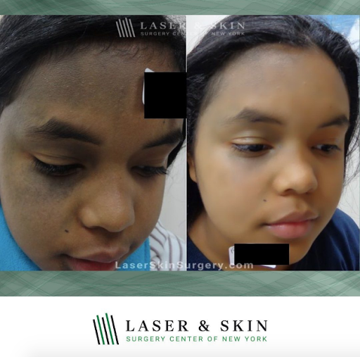 Explore dancing tattoo ideas, creative tattoo ideas in New York, available at Laser & Skin Surgery Center