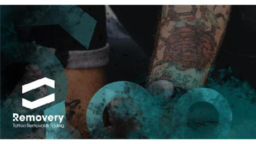 Explore chevy bowtie tattoo ideas, creative tattoo ideas in Albany, available at Removery Tattoo Removal & Fading