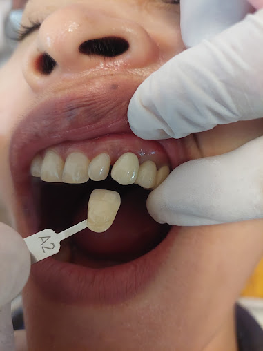 Angkor Meas Dental Clinic - Angkor Meas Dental Clinic