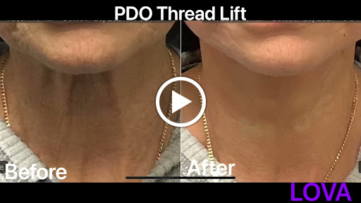 Explore scandinavian tattoo ideas, creative tattoo ideas in Lake Oswego, available at Lake Oswego Vein and Aesthetic LOVA