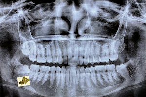 Paulino Dental Clinic - Urdaneta Dental Clinic image