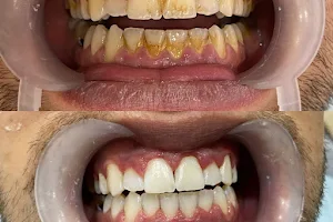 Ankara Nöbetçi Diş Hekimi, Acil Diş Hekimi, Gece Açık Dişçi, Acil Diş Kliniği image