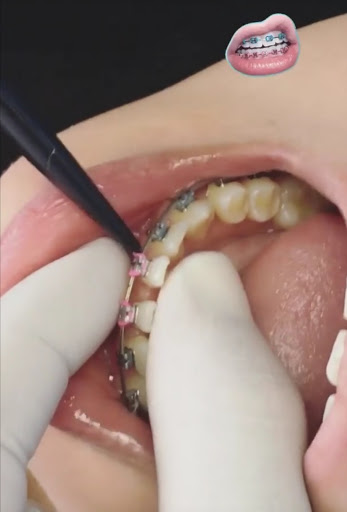 Dental del Valle