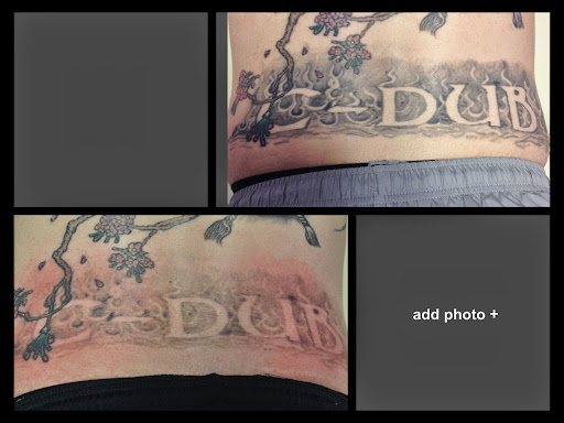Explore tattoo ideas rose, creative tattoo ideas in Colleyville, available at DFW Tattoo Removal