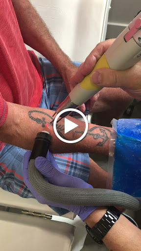 Explore small tattoo ideas on shoulder, creative tattoo ideas in Naples, available at Laser Tattoo Removal Services