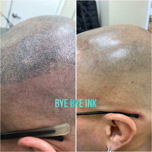 Explore three sisters tattoo ideas, creative tattoo ideas in Middle Village, available at Bye Bye Ink Laser Tattoo Removal