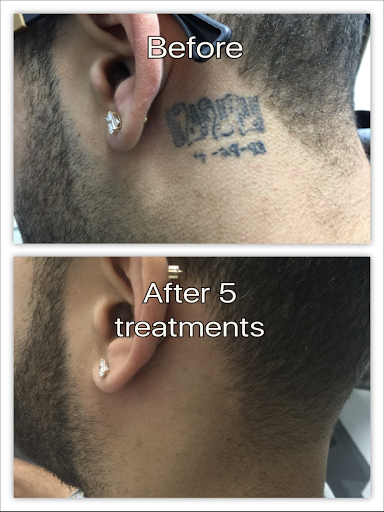 Explore ideas for daughters name tattoo, creative tattoo ideas in Honolulu, available at Removery Tattoo Removal & Fading
