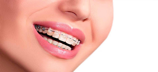 Dentistas ortodoncistas en Toluca de Lerdo