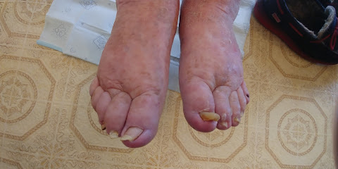 Jennifer's Mobile Nursing Foot Care