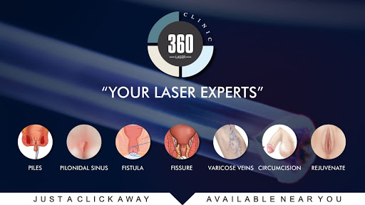 Laser 360 Clinic - Laser Treatment in Delhi | Laser Surgery NCR : Piles, Fissure, Fistula, Pilonidal Sinus, Varicose Veins Laser Treatment and Laser Vaginal Rejuvenation