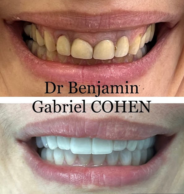 Dr Benjamin Gabriel Cohen - Dentisterie Esthétique Paris